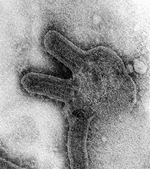 Marburg Virus